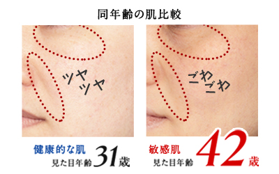 敏感肌は老けて見られる